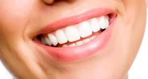 implantologia-dentale-1